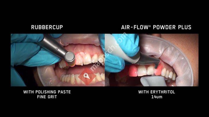EMS Dental - Australia & New Zealand